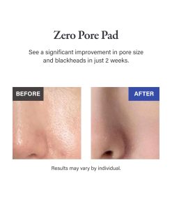 Alternative view of medicube Zero Pore Pad 2.0 (70 Pads)