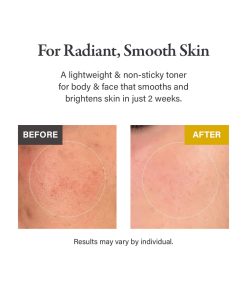 Alternative view of medicube Kojic Acid Turmeric Resurfacing Toner 250ml