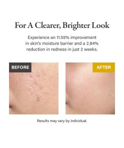 Alternative view of medicube Kojic Acid Turmeric Niacinamide Serum 30ml