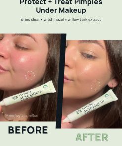 Alternative view of AOA Skin Invisible Acne Liquid Bandage