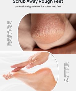 Alternative view of AOA Double-Sided Pedicure File